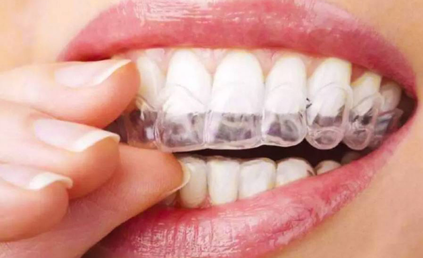 Tratamientos con Férulas